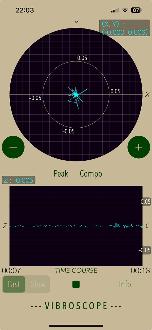 Vibroscope